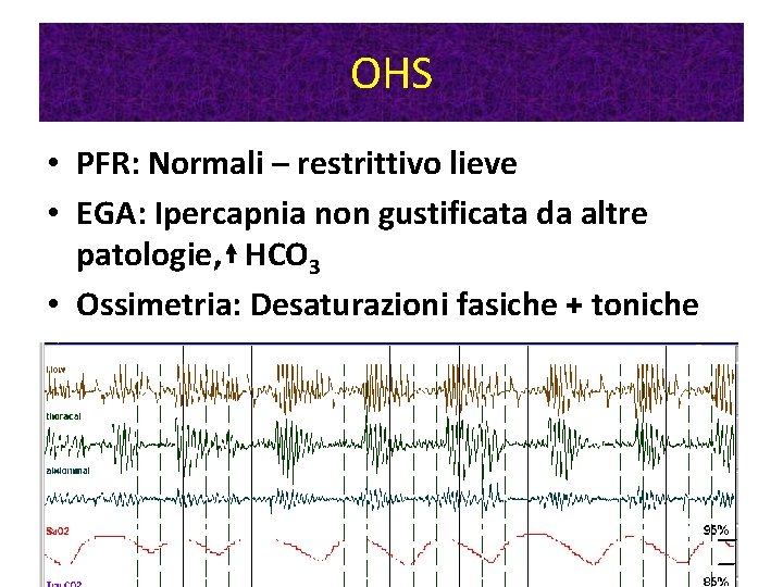 OHS • PFR: Normali – restrittivo lieve • EGA: Ipercapnia non gustificata da altre