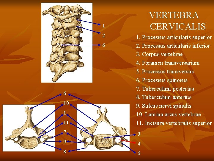 VERTEBRA CERVICALIS 1 2 6 6 10 1 11 1. Processus articularis superior 2.