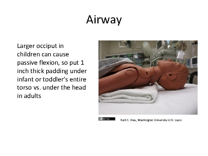 Airway Larger occiput in children cause passive flexion, so put 1 inch thick padding