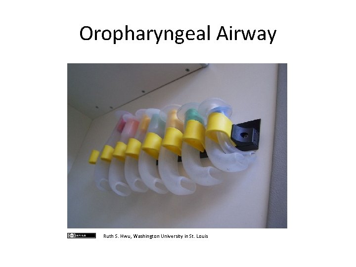 Oropharyngeal Airway Ruth S. Hwu, Washington University in St. Louis 