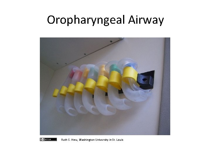 Oropharyngeal Airway Ruth S. Hwu, Washington University in St. Louis Oropharyngeal Airway Ruth S. Hwu, Washington University in St. Louis