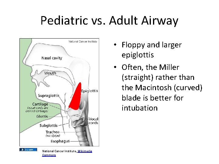Pediatric vs. Adult Airway • Floppy and larger epiglottis • Often, the Miller (straight)