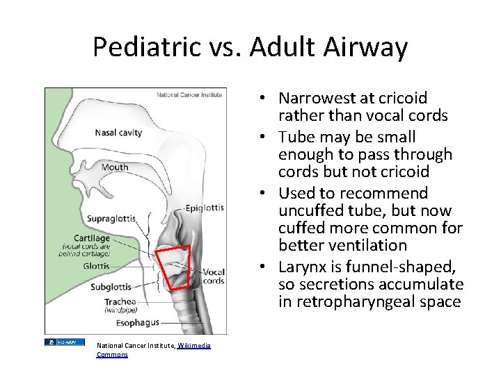 Pediatric vs. Adult Airway • Narrowest at cricoid rather than vocal cords • Tube