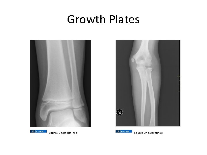 Growth Plates Source Undetermined Growth Plates Source Undetermined
