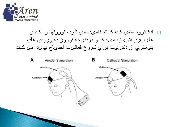 Brain Stimulation Methods Electroconvulsive therapy ECT Cranial electrical