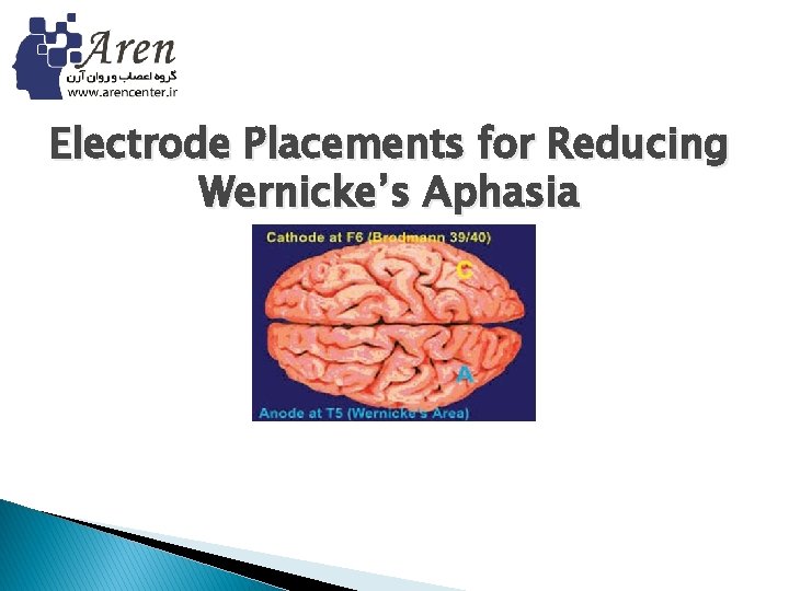 Electrode Placements for Reducing Wernicke’s Aphasia 
