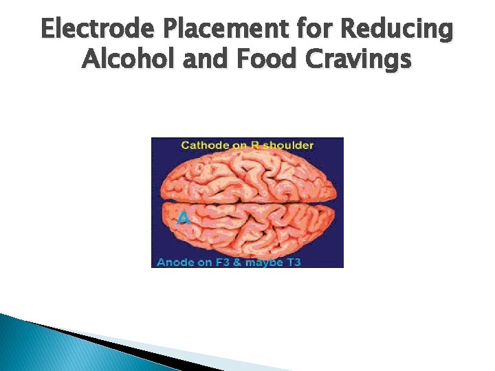 Electrode Placement for Reducing Alcohol and Food Cravings 