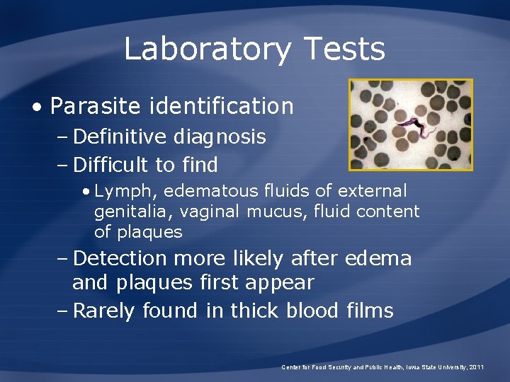 Laboratory Tests • Parasite identification – Definitive diagnosis – Difficult to find • Lymph,