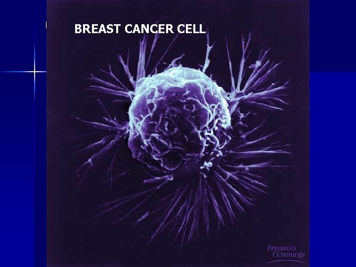 n BREAST CANCER CELL 