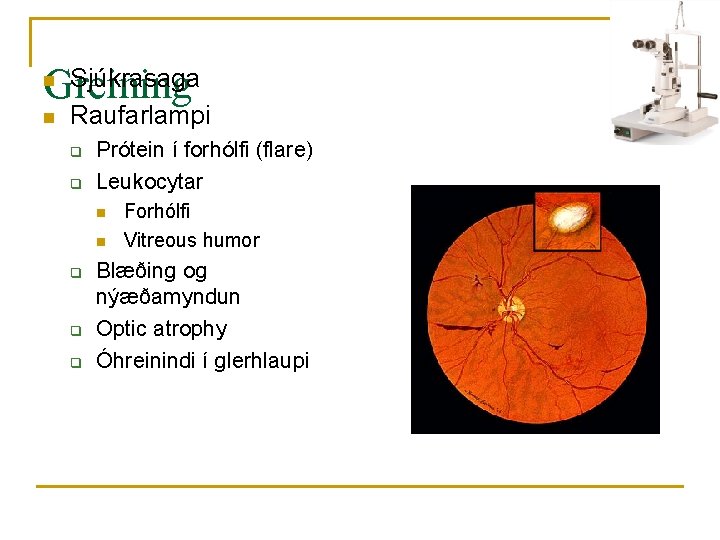 Sjúkrasaga Greining n n Raufarlampi q q Prótein í forhólfi (flare) Leukocytar n n