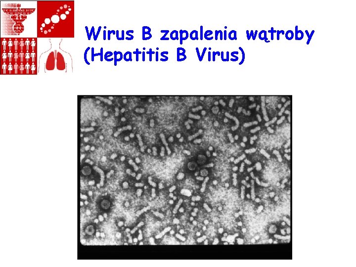 Wirus B zapalenia wątroby (Hepatitis B Virus) 