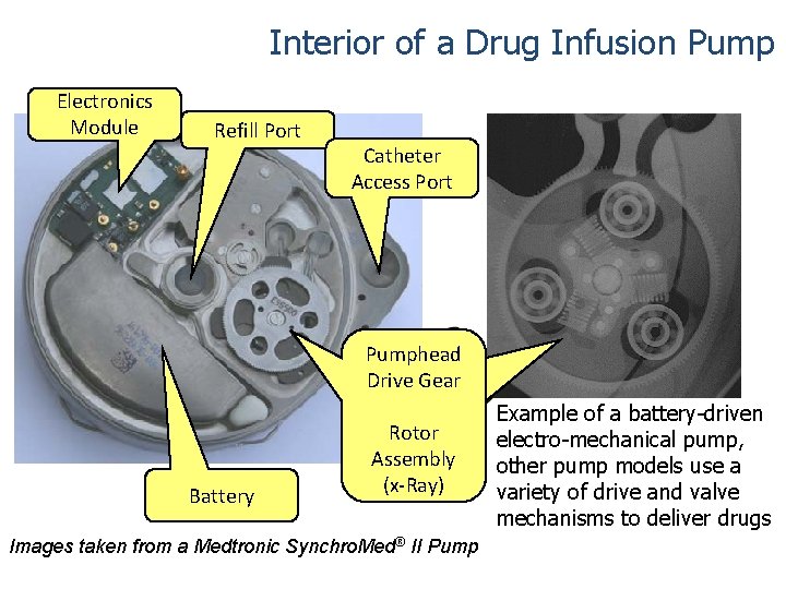 Interior of a Drug Infusion Pump Electronics Module Refill Port Battery Catheter Access Port