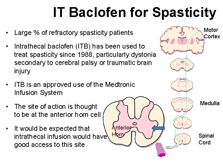IT Baclofen for Spasticity • Large % of refractory spasticity patients Motor Cortex •