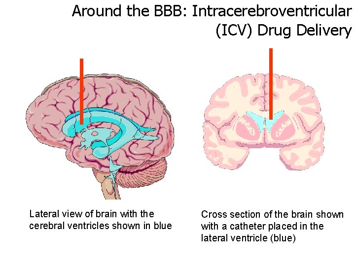 Around the BBB: Intracerebroventricular (ICV) Drug Delivery Lateral view of brain with the cerebral