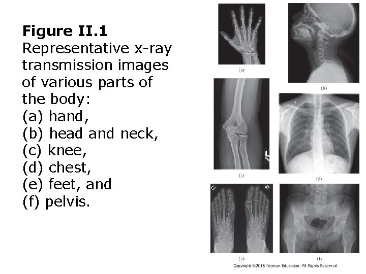 Figure II. 1 Representative x-ray transmission images of various parts of the body: (a)