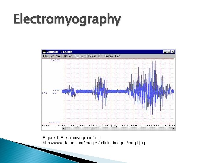 Electromyography Figure 1: Electromyogram from http: //www. dataq. com/images/article_images/emg 1. jpg 