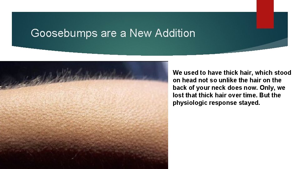 Goosebumps are a New Addition We used to have thick hair, which stood on
