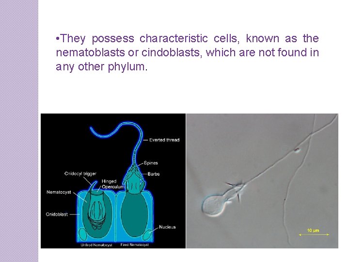  • They possess characteristic cells, known as the nematoblasts or cindoblasts, which are
