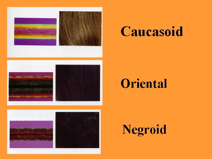 Caucasoid Oriental Negroid 