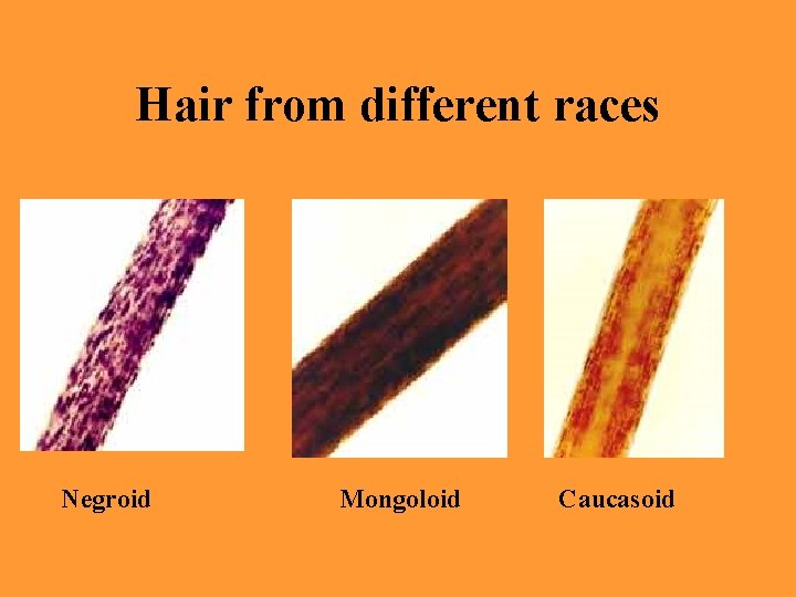 Hair from different races Negroid Mongoloid Caucasoid 