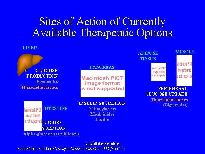 Sites of Action of Currently Available Therapeutic Options LIVER ADIPOSE TISSUE PANCREAS GLUCOSE PRODUCTION