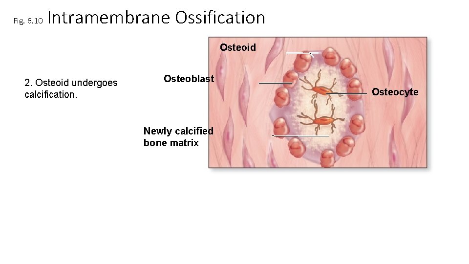 Fig. 6. 10 Intramembrane Ossification Osteoid 2. Osteoid undergoes calcification. Osteoblast Osteocyte Newly calcified Fig. 6. 10 Intramembrane Ossification Osteoid 2. Osteoid undergoes calcification. Osteoblast Osteocyte Newly calcified