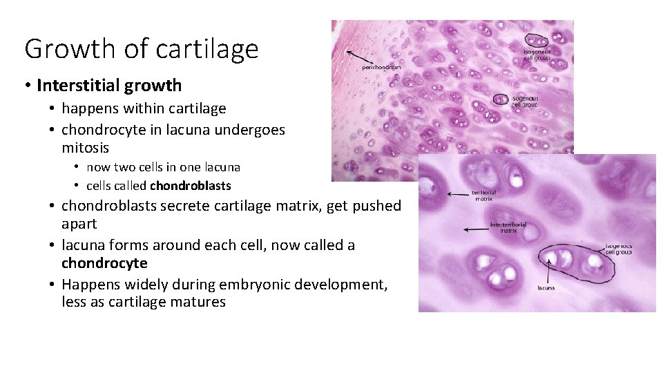 Growth of cartilage • Interstitial growth • happens within cartilage • chondrocyte in lacuna Growth of cartilage • Interstitial growth • happens within cartilage • chondrocyte in lacuna