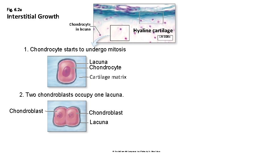 Fig. 6. 2 a Interstitial Growth Chondrocyte in lacuna Hyaline cartilage LM 320 x Fig. 6. 2 a Interstitial Growth Chondrocyte in lacuna Hyaline cartilage LM 320 x