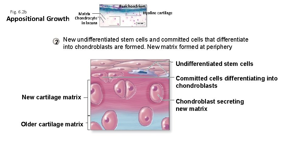 Fig. 6. 2 b Perichondrium Appositional Growth Matrix Chondrocyte in lacuna Hyaline cartilage LM Fig. 6. 2 b Perichondrium Appositional Growth Matrix Chondrocyte in lacuna Hyaline cartilage LM