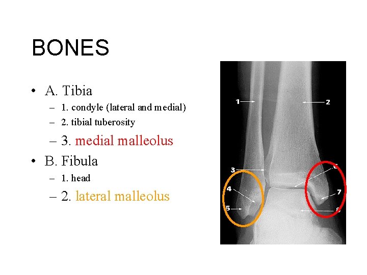 BONES • A. Tibia – 1. condyle (lateral and medial) – 2. tibial tuberosity