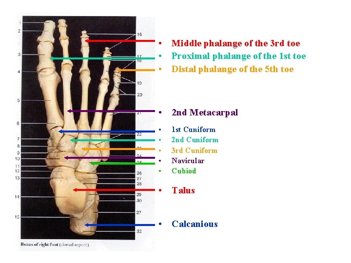  • Middle phalange of the 3 rd toe • Proximal phalange of the