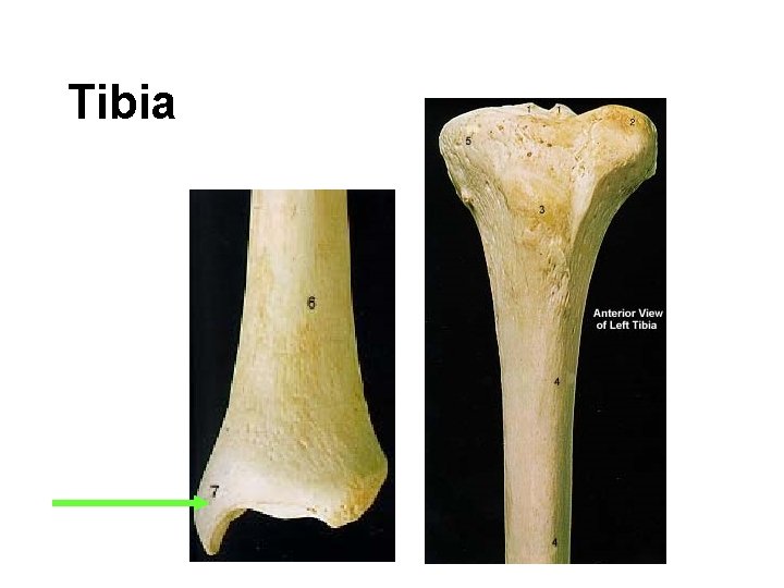 Tibia 