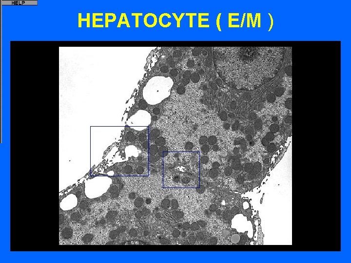 HEPATOCYTE ( E/M ) 