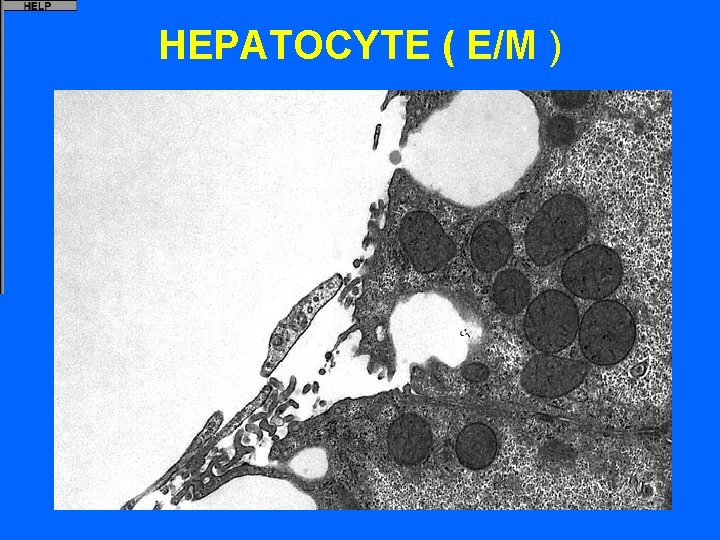 HEPATOCYTE ( E/M ) 