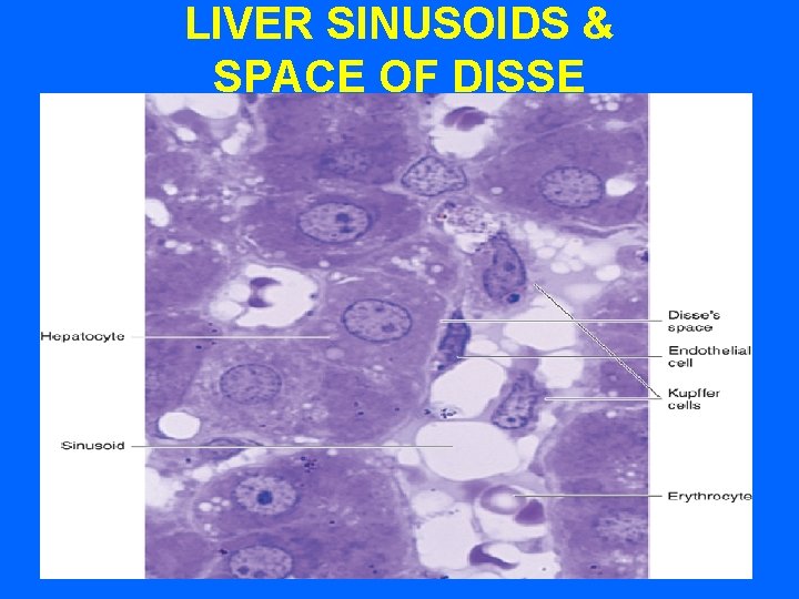 LIVER SINUSOIDS & SPACE OF DISSE 