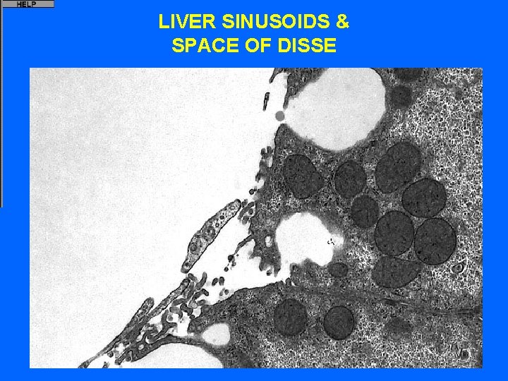 LIVER SINUSOIDS & SPACE OF DISSE 
