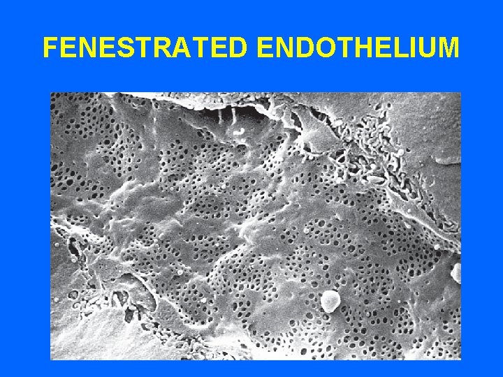 FENESTRATED ENDOTHELIUM 