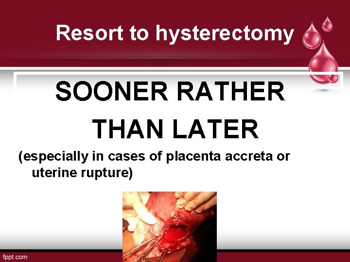 Resort to hysterectomy SOONER RATHER THAN LATER (especially in cases of placenta accreta or