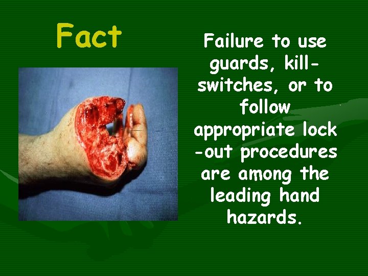 Fact Failure to use guards, killswitches, or to follow appropriate lock -out procedures are