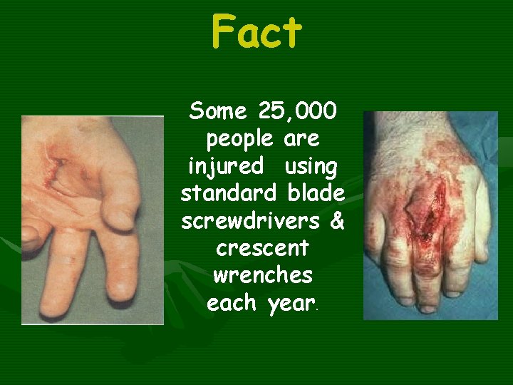 Fact Some 25, 000 people are injured using standard blade screwdrivers & crescent wrenches