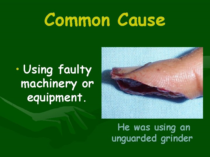 Common Cause • Using faulty machinery or equipment. He was using an unguarded grinder