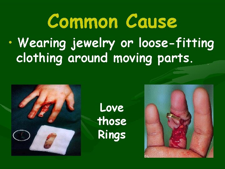 Common Cause • Wearing jewelry or loose-fitting clothing around moving parts. Love those Rings