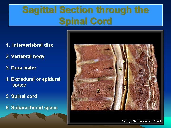 Sagittal Section through the Spinal Cord 1. Intervertebral disc 2. Vertebral body 3. Dura