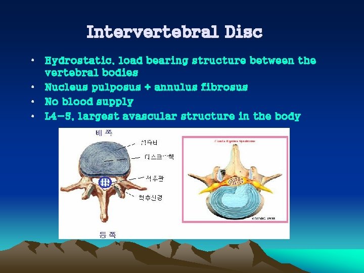 Intervertebral Disc • Hydrostatic, load bearing structure between the vertebral bodies • Nucleus pulposus