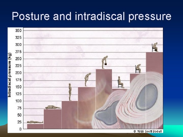 Posture and intradiscal pressure 