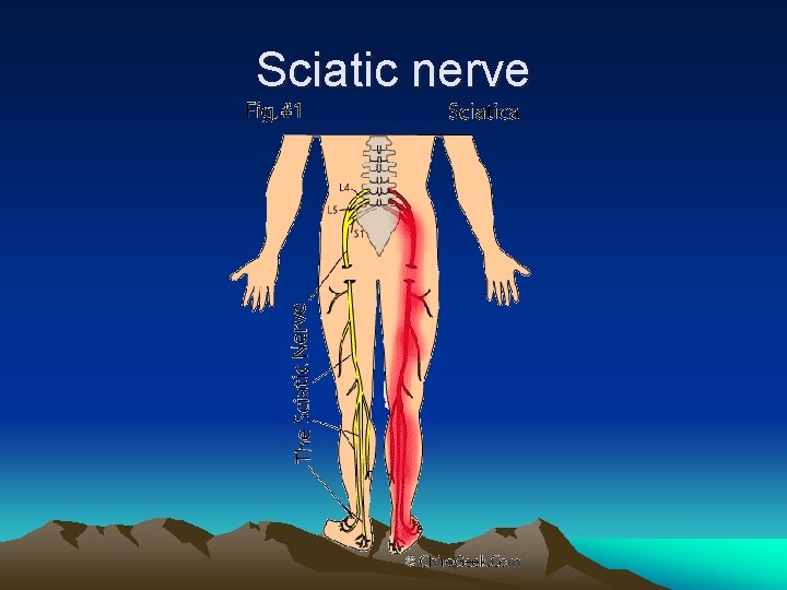 Sciatic nerve 