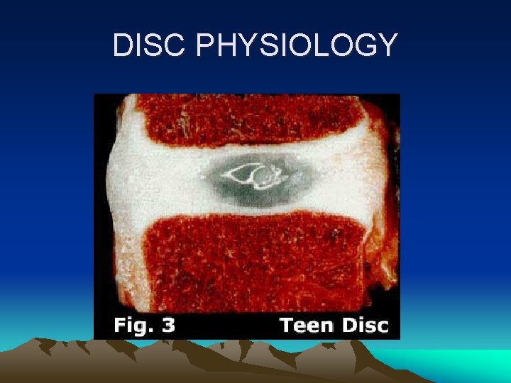 DISC PHYSIOLOGY 