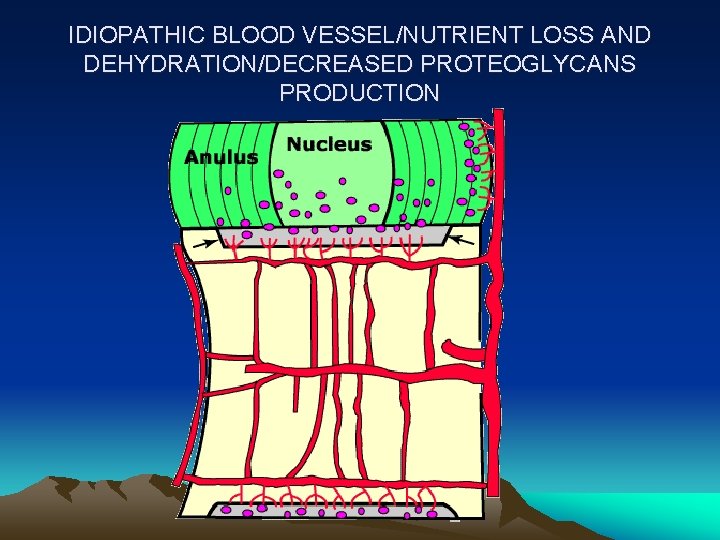 IDIOPATHIC BLOOD VESSEL/NUTRIENT LOSS AND DEHYDRATION/DECREASED PROTEOGLYCANS PRODUCTION 