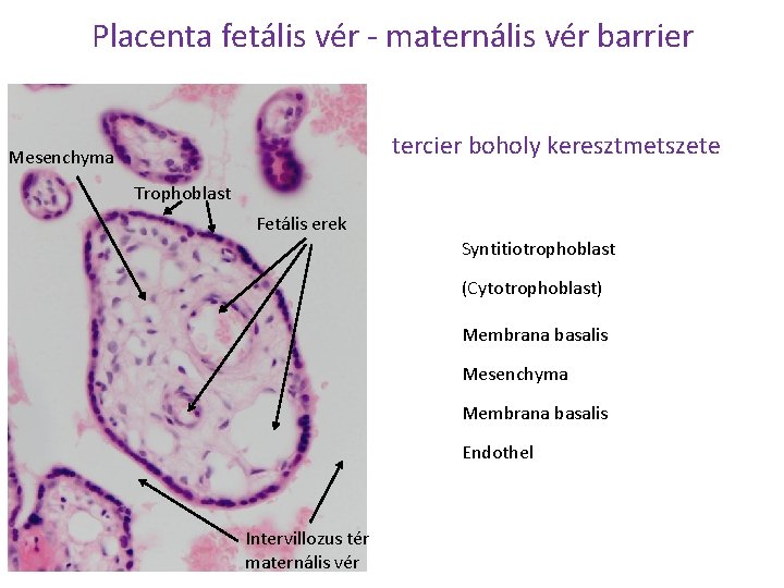Placenta fetális vér - maternális vér barrier tercier boholy keresztmetszete Mesenchyma Trophoblast Fetális erek