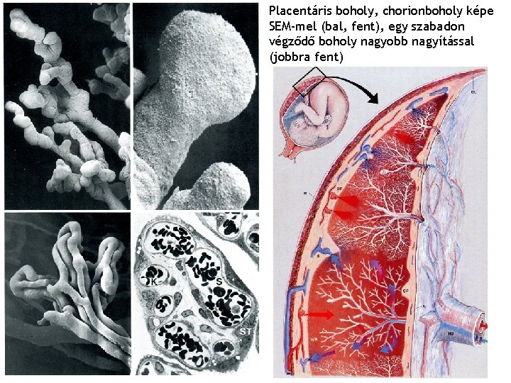 Placentáris boholy, chorionboholy képe SEM-mel (bal, fent), egy szabadon végződő boholy nagyobb nagyítással (jobbra